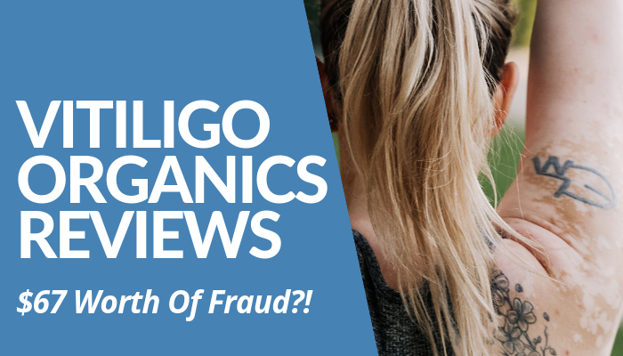 Read My Vitiligo Organics Reviews Post Before You Invest In Scammy Organic Product From Australia. Description Lured People To Spend Without Effects. Read More.